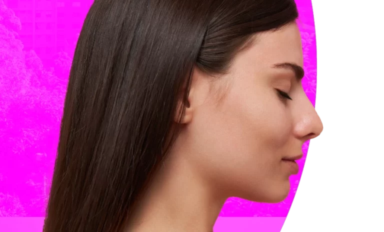 Rinoplastia LP Internacional 1 rinoplastia en Colombia